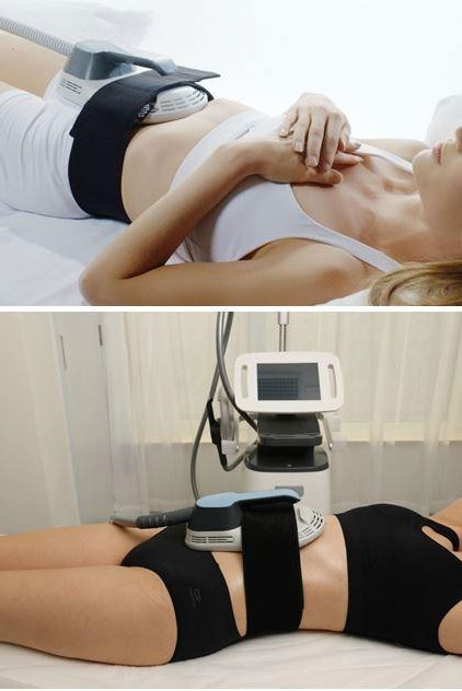 Εκγύμναση των μυών με EMSlimPRO®