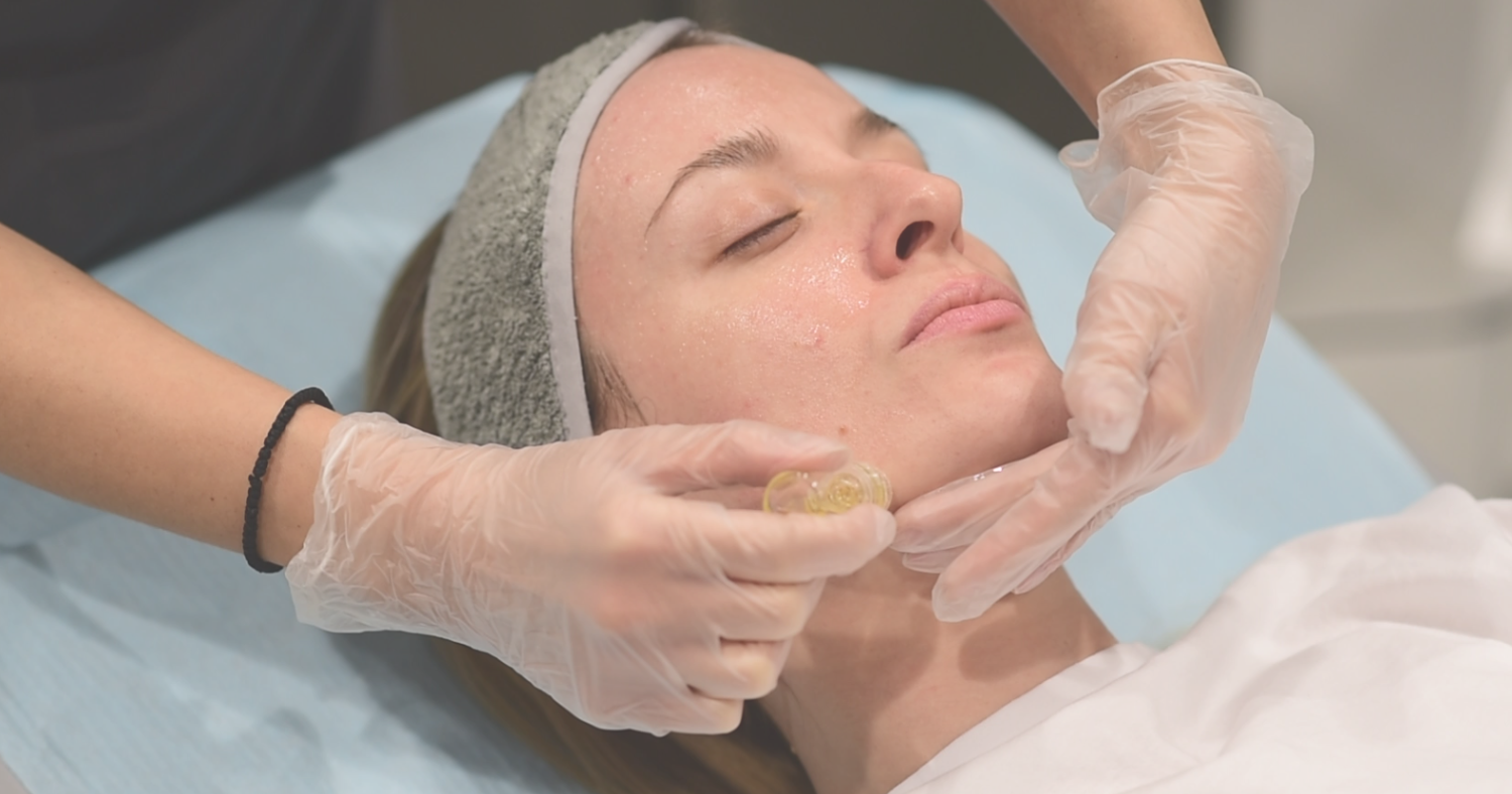 Μεσοθεραπεία hydra needle micro-infusion