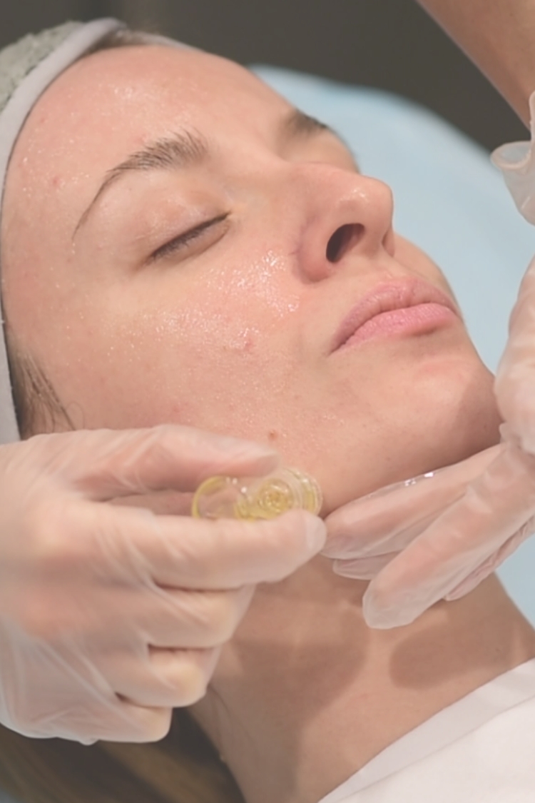 Μεσοθεραπεία hydra needle micro-infusion