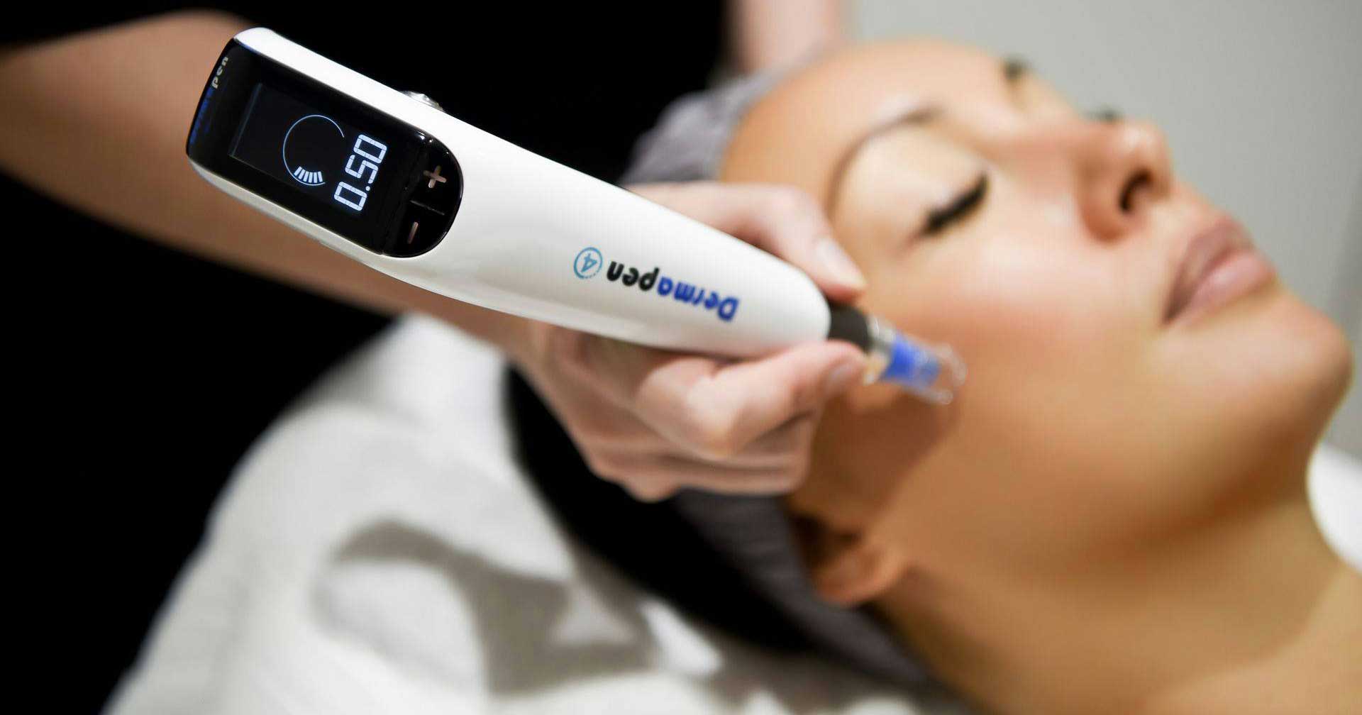Microneedling