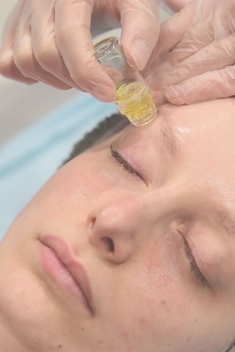 Θεραπεία Ματιών Global Eyecon της Mesoestetic